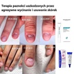 Akileine ECRINAL® Krem do paznokci wzmacniający i przyspieszający wzrost 10 ml 