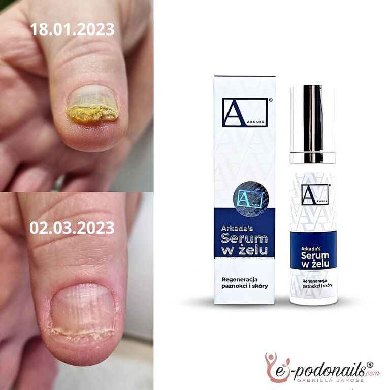 Arkada® Serum - Żel do Paznokci i Skóry Twarzy | Pielęgnacja 2w1