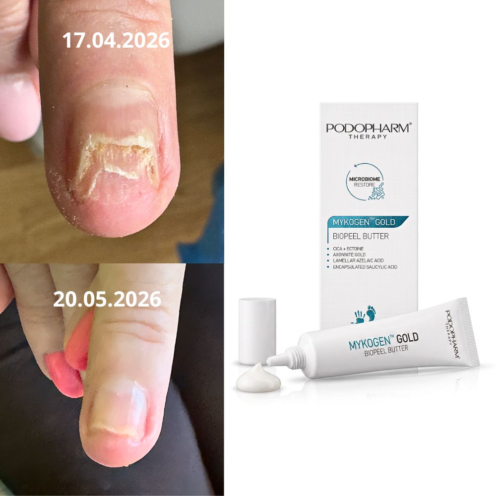 Podopharm® Mykogen™ Gold Masło na grzybicę paznokci 20 ml (2)