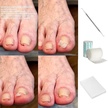  Ligasano® tamponada - wrastające paznokcie rolka 3 m x 5cm x 0.3 cm  (2)