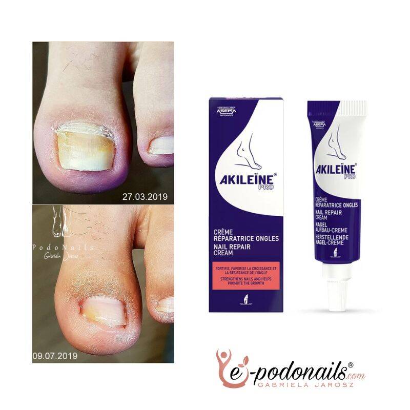 Akileine Pro Krem do paznokci 10 ml – regeneracja i odbudowa płytki